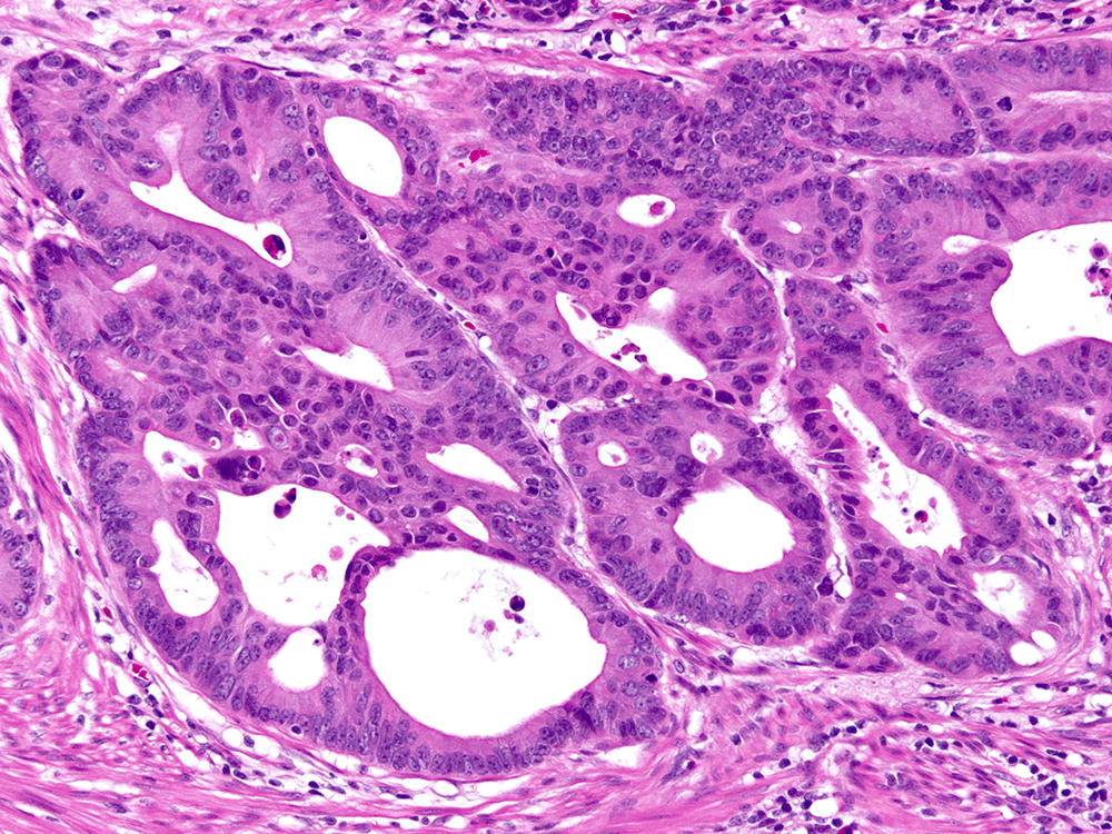 Cleveland Clinic Laboratories Pathology Subspecialty Consultative Services