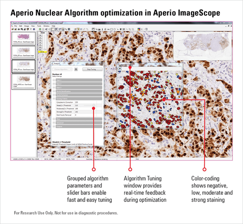 Aperio imagescope software