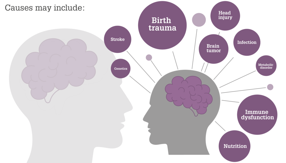 by-the-numbers-epilepsy-and-neurodevelopmental-disorders