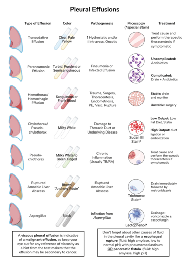 An infographic that compares different pleural effusions based on type, fluid color, pathogenesis, microscopy, and treatment to support differential diagnosis in the clinic.