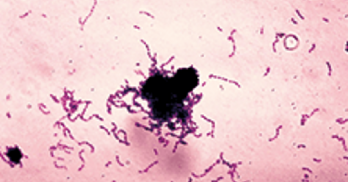 The Six Faces of Streptococcus pneumoniae
